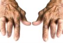 Comité de Pacientes  de Artritis Reumatoide hace recomendaciones sobre la enfermedad